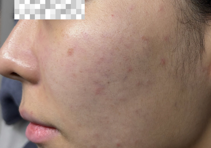After